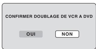 SHARP DV-RW270F - Remarque: - 1