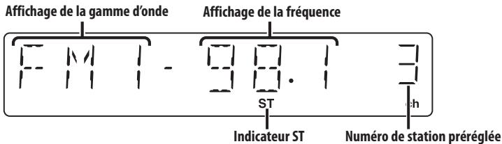 KENWOOD DNR-1000U - Écouter l'autoradio pendant un appel - 3