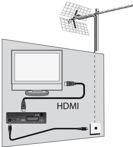METRONIC ZAPBOX HD-M1,  ZAPBOX HD-S1,  ZAPBOX HD-Z3 IP - A - Instalación simplificada - 1