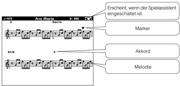 YAMAHA ARIUS YDP-V240 - Notendarstellung anzeigen. - 2