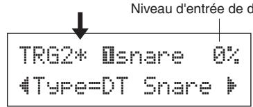 YAMAHA DTXPRESS IV - Procédure de configuration du déclenchement - 3