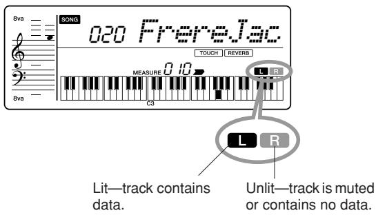YAMAHA PSR-E323 - Mute - 2