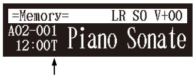 YAMAHA DISKLAVIER E3 CLASSIC - Au sujet de l'écran de lecture de chanson - 1
