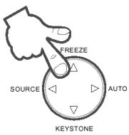 SAGEM MLP 1100-X - Figer - 1