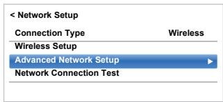 TOSHIBA W4333 - Auto Setup - 1