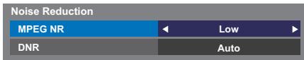 Noise Reduction MPEG NR Low DNR Auto