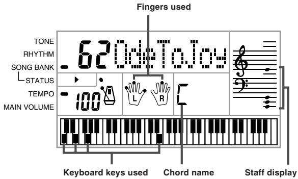 CASIO CTK-451 - To play back a Song Bank tune - 4