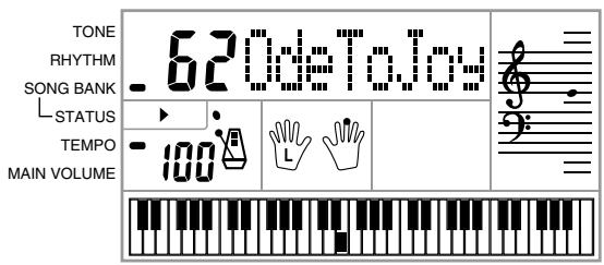CASIO CTK-451 - To play back a Song Bank tune - 5