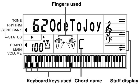 CASIO CTK-491 - To play back a Song Bank tune - 4