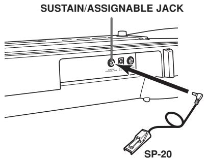 CASIO LK-93TV - Sustain/Assignable Jack - 1
