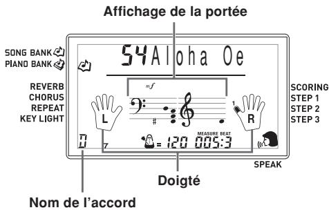CASIO LK-215 - REMARQUE - 1