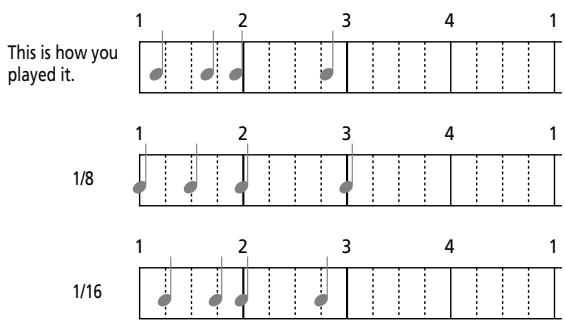 ROLAND E-80 - Preparations - 5