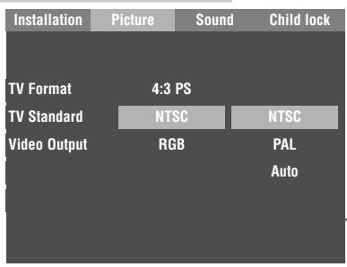 GRUNDIG GDP 1100/1 - Note: - 1