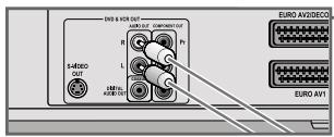 GRUNDIG GDR 6460 VCR DVD OPTAGER - Connecting an audio system with analogue two-channel stereo sound - 3