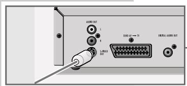 GRUNDIG XENARO GDP 5100 - Note: - 1