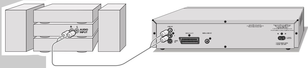 GRUNDIG XENARO GDP 5100 - Connecting to a HiFi system with analogue two-channel stereo sound - 1