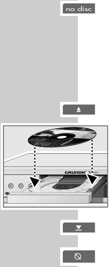 GRUNDIG XENARO GDP 5120 - Note: - 1