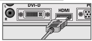 GRUNDIG XEPHIA 42 PXW 110-6721 DOLBY - With a digital audio/video signal - 1