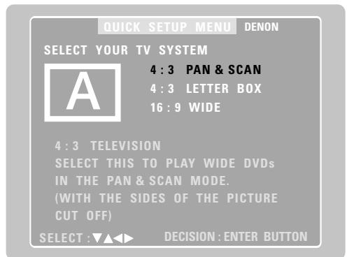 DENON D-M51DVS - [1] TV screen size setting - 1