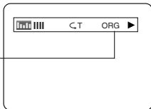 DENON DVM-1815 - Dvd-v - 4