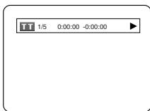 DENON DVM-1815 - Dvd-v - 3