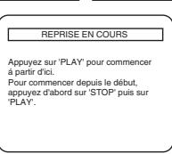 DENON DVM-1815 - Dvd-v - 1