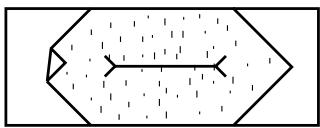 ELNA 7200 - Bound Buttonhole (4 Step Memory) - 8