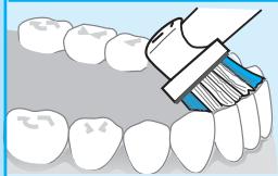 BRAUN ORALB PROFESSIONALCARE 9500 - Benutzung der Oral-B Triumph - 7