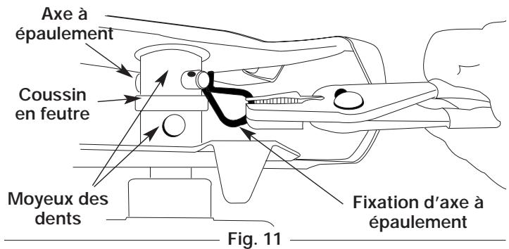 MTD 410R - Retrait et remplacement des DENTS - 2