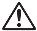 HITACHI CP-RX94 - Be careful in handling the battery of the remote control. - 2