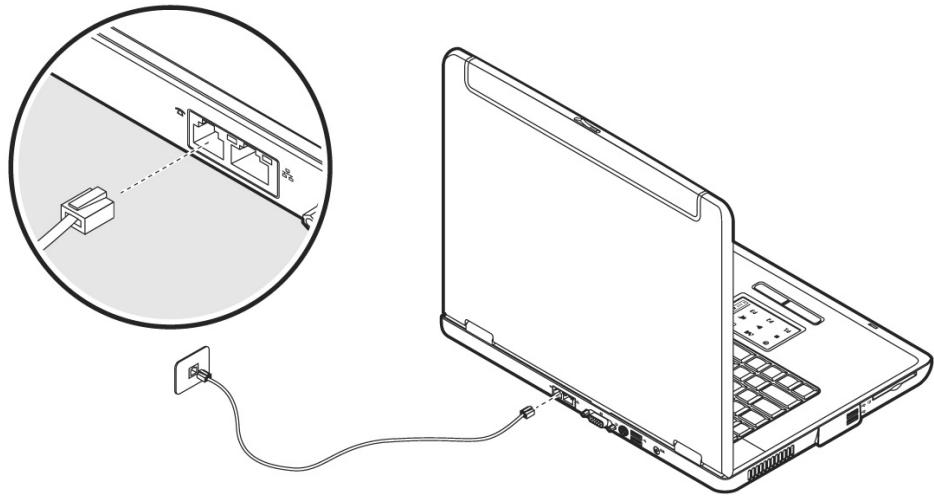 MEDION BDAWIM2090 - Branchement du modem - 1