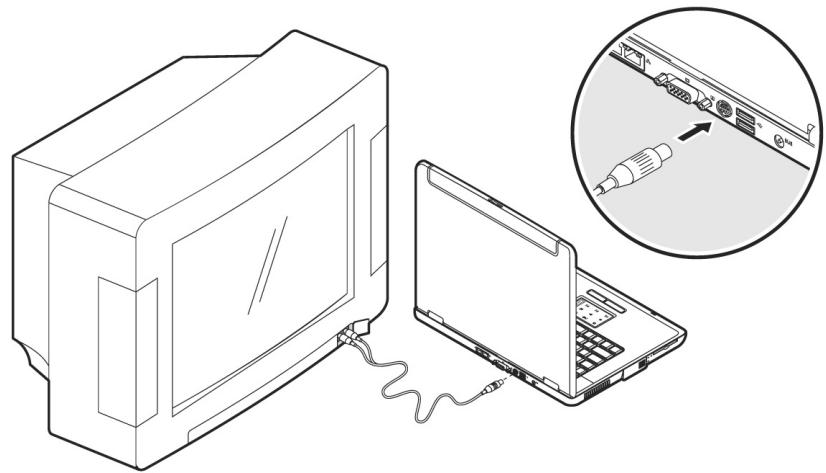 MEDION BDAWIM2090 - Branchement d'un téléviseur - 1