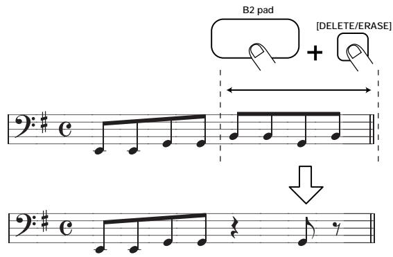 ZOOM RT234 - STEP10 - 3