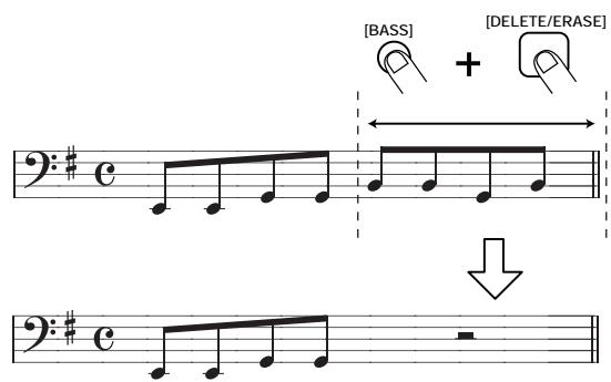 ZOOM RT234 - STEP10 - 4