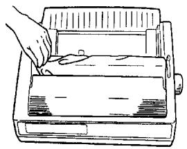 OKI ML 591 - Remove the Shipping Retainers - 1