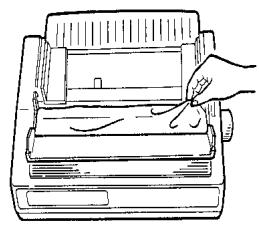 OKI ML 591N - Remove the Shipping Retainers - 2