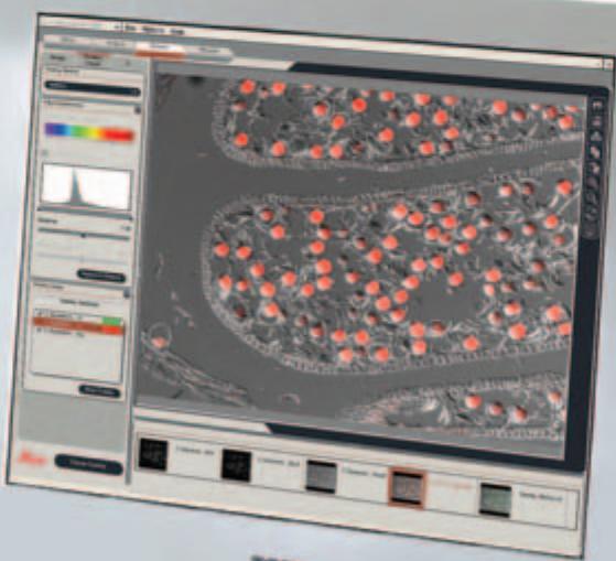 LEICA APPLICATION SUITE IMAGE OVERLAY - Annotation - 1
