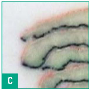 LEICA CRYOEMBEDDING - The Results - 3