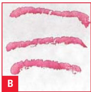 LEICA CRYOEMBEDDING - The Results - 2
