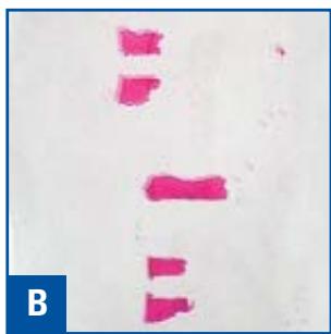 LEICA CRYOEMBEDDING - The Results - 2