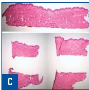 LEICA CRYOEMBEDDING - The Results - 3