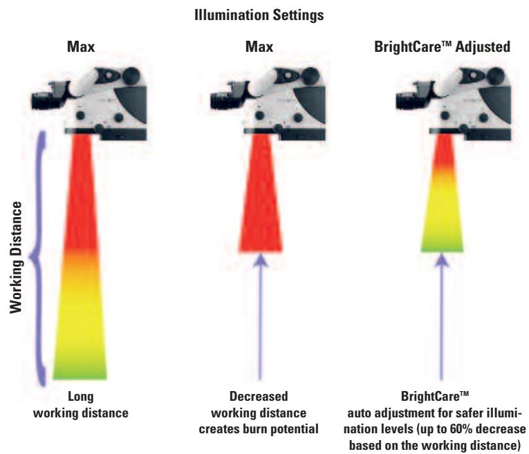LEICA M720 OH5 - BrightCare™ – Working-distance-controlled illumination - 1