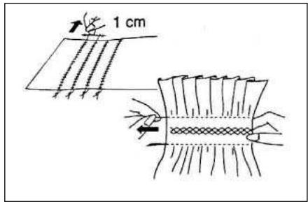 PRIMERA NM902 - Point de suture - 1