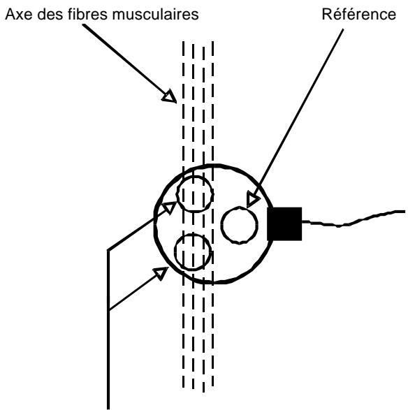 COMPEX -2 - a) Installation du (des) capteur(s) - 1