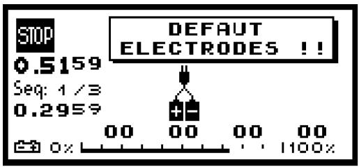 COMPEX -2 - b) Défaut d'électrodes - 1