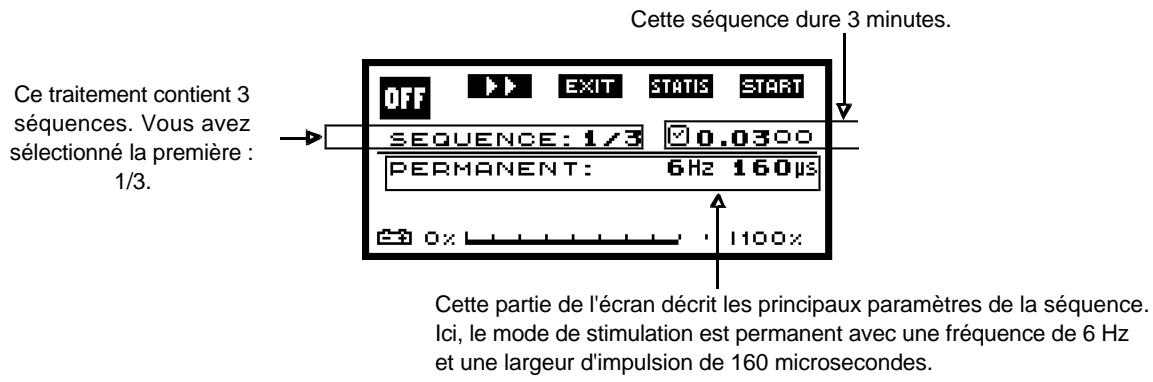 COMPEX -2 - b) Ecran "SEQUENCE" - 1