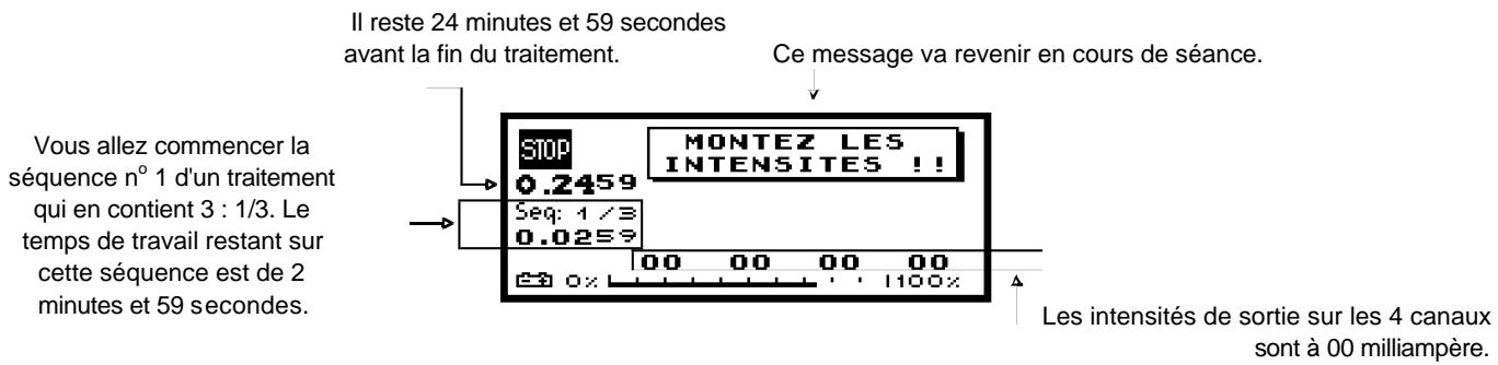 COMPEX -2 - Canaux antalgiques - "TENS Gate Control": - 2