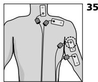 COMPEX MI THETA PRO - Position du corps - 1