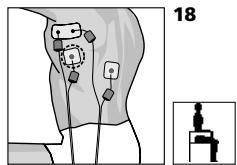 COMPEX MI THETA PRO - Placement des électrodes et position du corps - 1