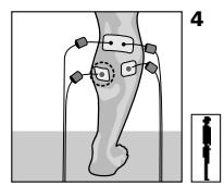 COMPEX MI THETA PRO - Placement des électrodes et position du corps - 1